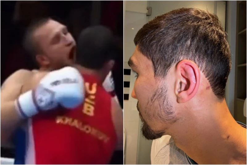 Позор на чемпионате мира: российский боксер укусил соперника за ухо и победил