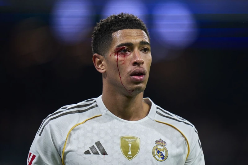 Jud Bellingemin qaşından zədə almasına baxmayaraq, Selta ilə oyunu davam etdirməsi