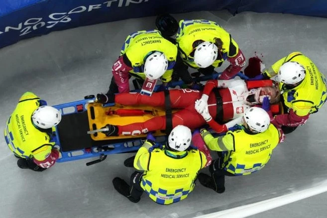 Kamila Selye Olimpiyat Kazası Sonrası İlk Kez Görüntülendi: Yüzünde Yara İzi ve Titanyum Ağ ile