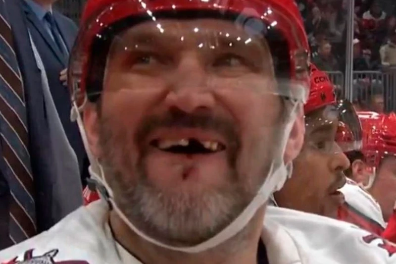 Ovechkin loses a tooth again: Roughness goes unpunished
