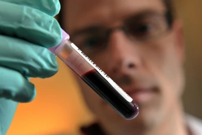 Təbriz Səfərov 2 illik diskvalifikasiya olundu