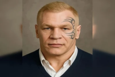 Mayk Tayson dərisi ağarmış fotosunu paylaşaraq şərhlərə səbəb oldu