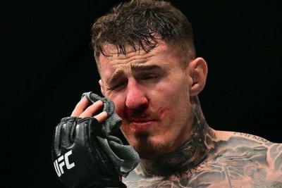 Tom Aspinallın Göz Zədəsi Ciddi Diaqnozlarla Təsdiqləndi