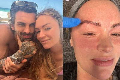 Laura Vuds qəzadan sonra keçirdiyi ağrıları və bərpa prosesini açıqladı - FOTO